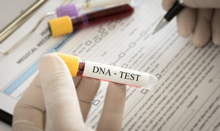 DNA paternity test